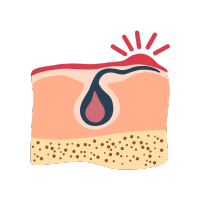 Inflamaciones